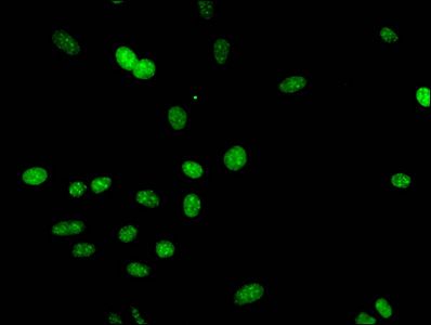 Tri-methyl-HIST1H3A (K9) Antibody