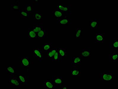 Tri-methyl-HIST1H3A (K9) Antibody