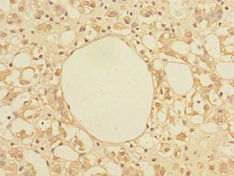 TRIAP1 Antibody