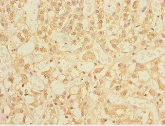 TRIAP1 Antibody