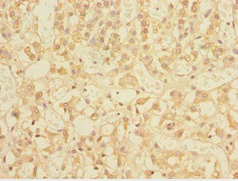 TRIAP1 antibody