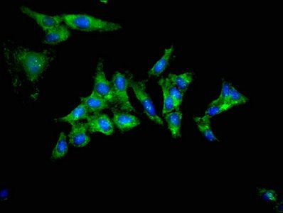 TRIB2 Antibody