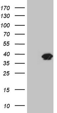 TRIB3 Antibody