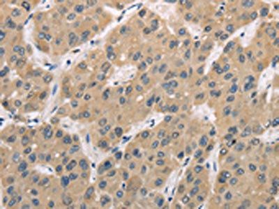 TRIB3 Antibody