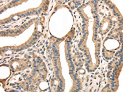 TRIB3 Antibody