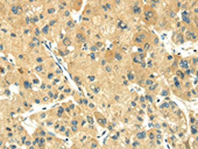 TRIM10 Antibody