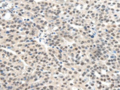 TRIM11 Antibody