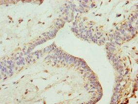 TRIM13 Antibody