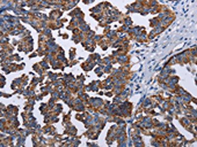 TRIM13 Antibody