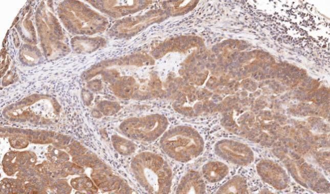 TRIM23 antibody [N1], N-term