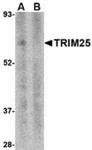 TRIM25 Antibody