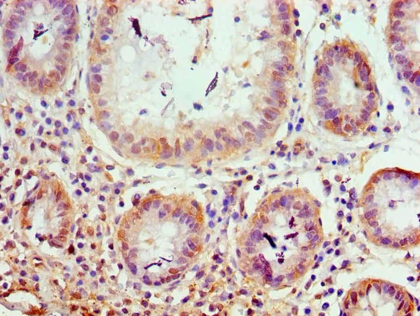 TRIM27 Antibody