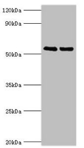 TRIM27 antibody