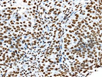 TRIM27 antibody