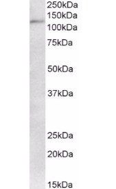 TRIM28 antibody