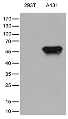 TRIM29 Antibody