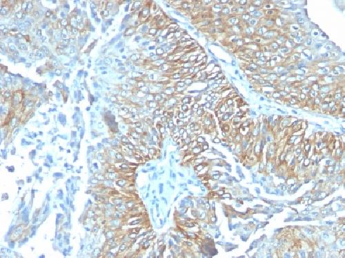 TRIM29 (Lung Squamous Cell Carcinoma Marker) Antibody