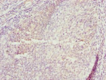 TRIM29 Antibody