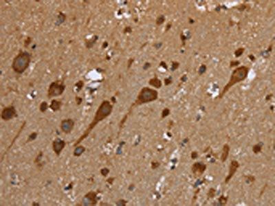 TRIM29 Antibody