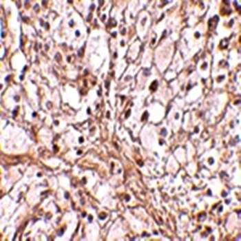 TRIM30 Antibody