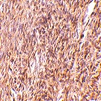 TRIM30 Antibody