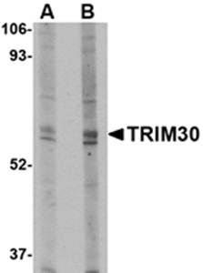 TRIM30 Antibody