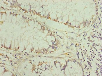 TRIM31 Antibody