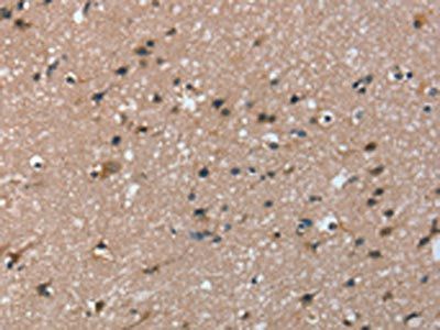 TRIM31 Antibody