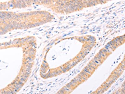 TRIM32 Antibody