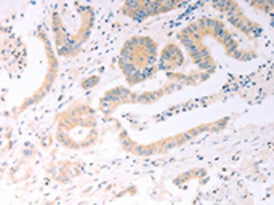 TRIM32 Antibody