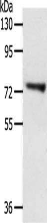 TRIM32 antibody