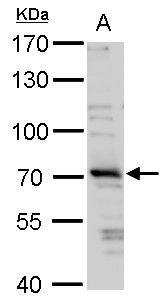 tripartite motif containing 32 Antibody