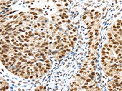 TRIM33 Antibody