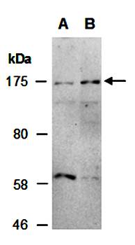 TRIM33 (C2) Antibody, Rabbit Polyclonal