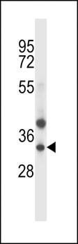 TRIM34 antibody