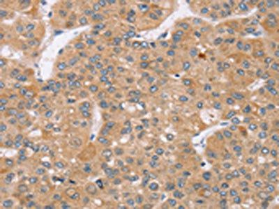 TRIM34 Antibody