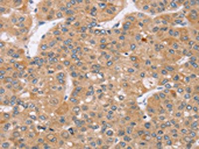 TRIM34 antibody