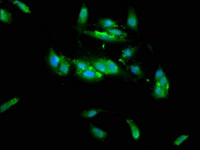 TRIM35 Antibody