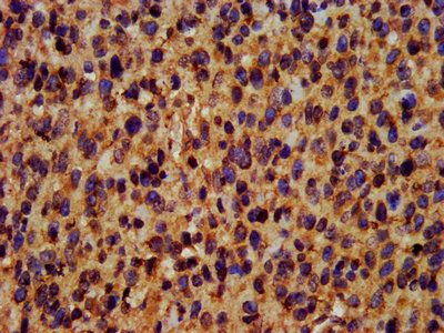 TRIM35 Antibody