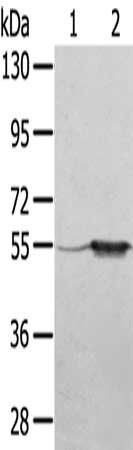 TRIM35 Antibody