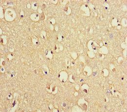 TRIM36 Antibody
