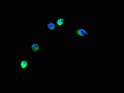 TRIM37 antibody