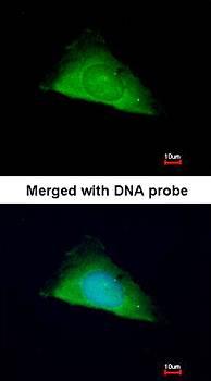 TRIM37 antibody