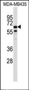 TRIM39 antibody
