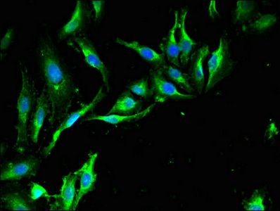 TRIM39 Antibody