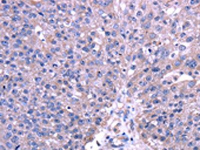 TRIM49 Antibody