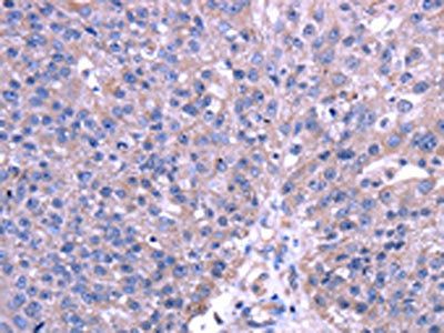 TRIM49 antibody