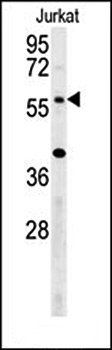 TRIM50 antibody