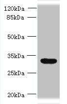 TRIM51 antibody