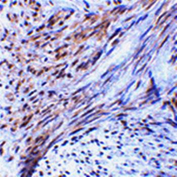 TRIM5 alpha Antibody
